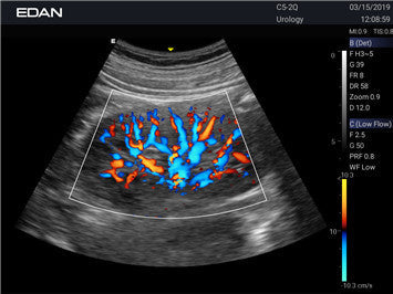 Edan Acclarix AX3 Compact Color Doppler Ultrasound System Minerva Health Solutions Inc.