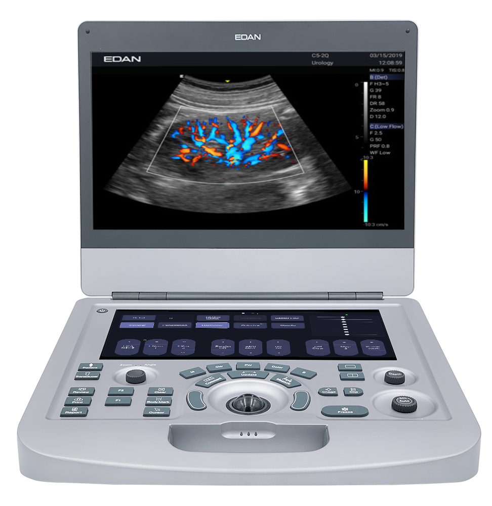 Edan Acclarix AX3 Compact Color Doppler Ultrasound System Minerva Health Solutions Inc.