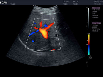 Edan Acclarix AX8 Ultrasound Machine Minerva Health Solutions Inc.