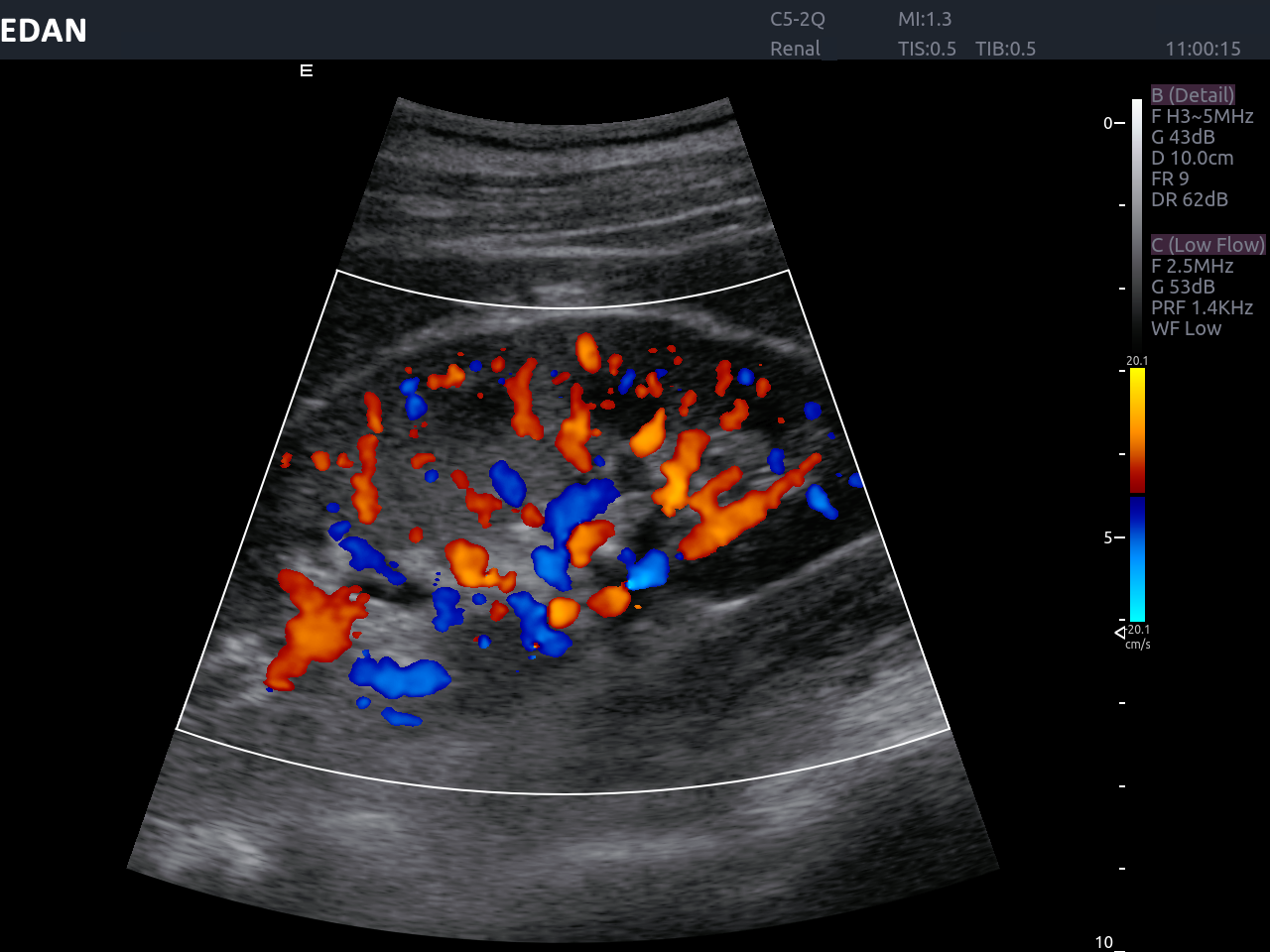 Edan Acclarix AX8 Ultrasound Machine