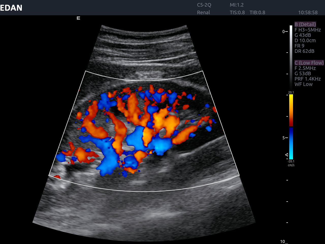 Edan Acclarix AX8 Ultrasound Machine Minerva Health Solutions Inc.