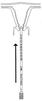 Fertility Assessment SelectMucus Endocervical Aspirator