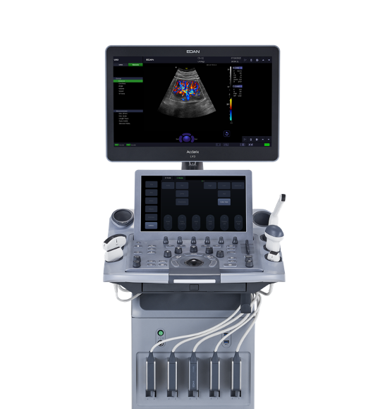 LX9 Diagnostic Ultrasound Machine Minerva Health Solutions Inc.