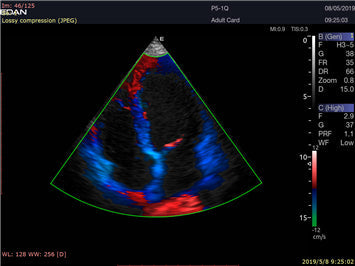 LX9 Diagnostic Ultrasound Machine Minerva Health Solutions Inc.