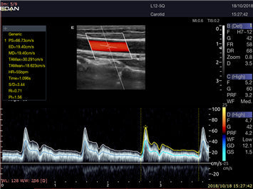 LX9 Diagnostic Ultrasound Machine Minerva Health Solutions Inc.