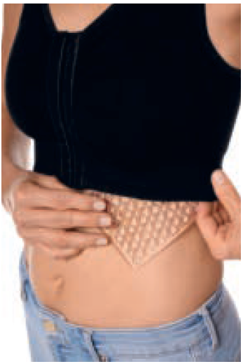Curalymph Compression - Lymph Flow Pressure Pad Amoena