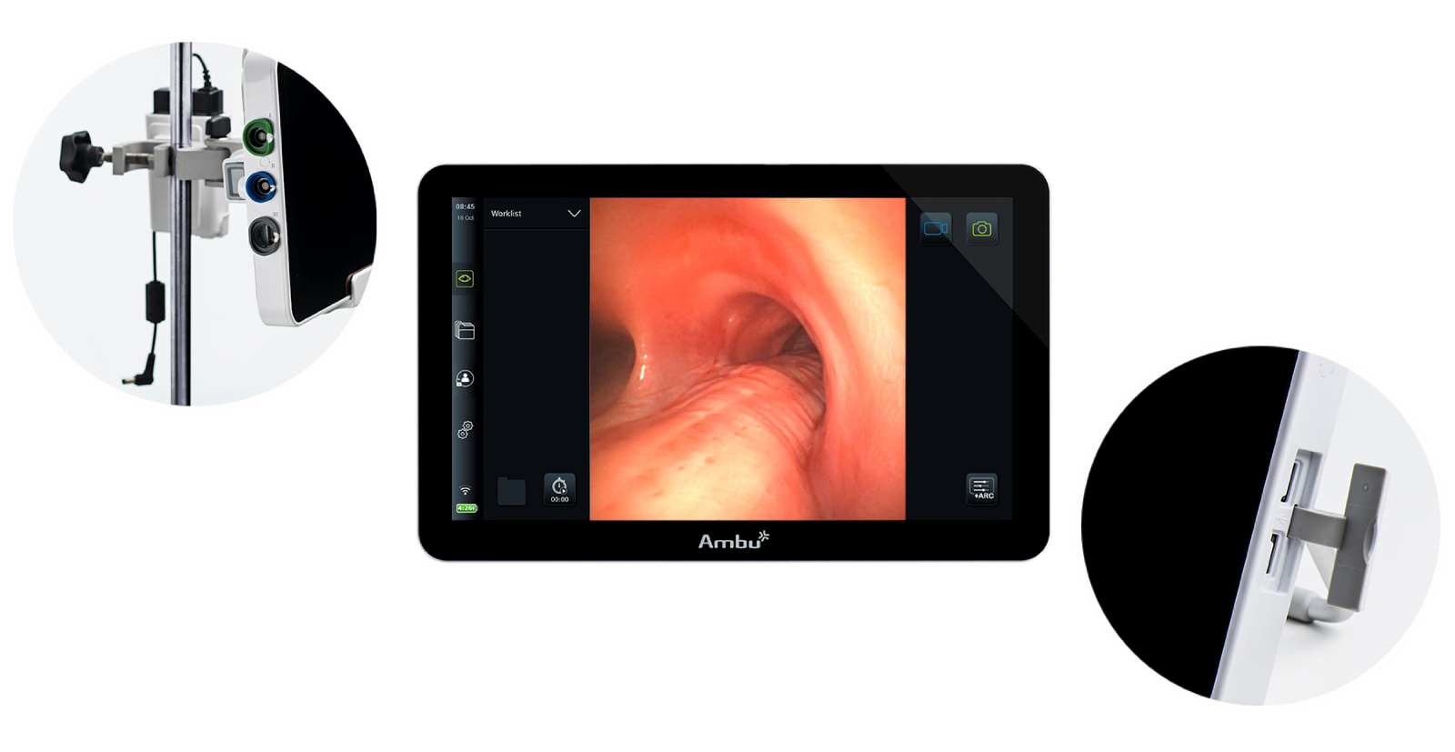 Ambu aView 2 Advance Gen. 2