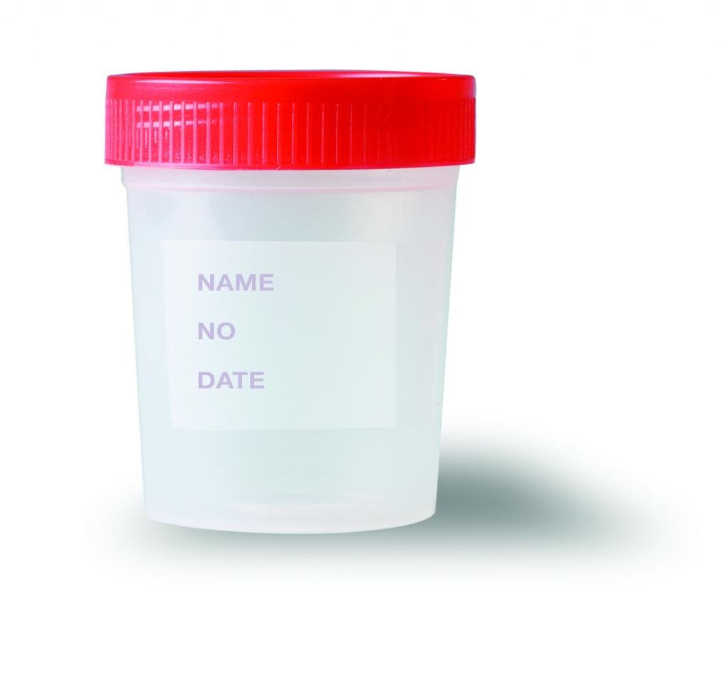 4 oz. Specimen Containers & Semen Collection Cups Globe Scientific
