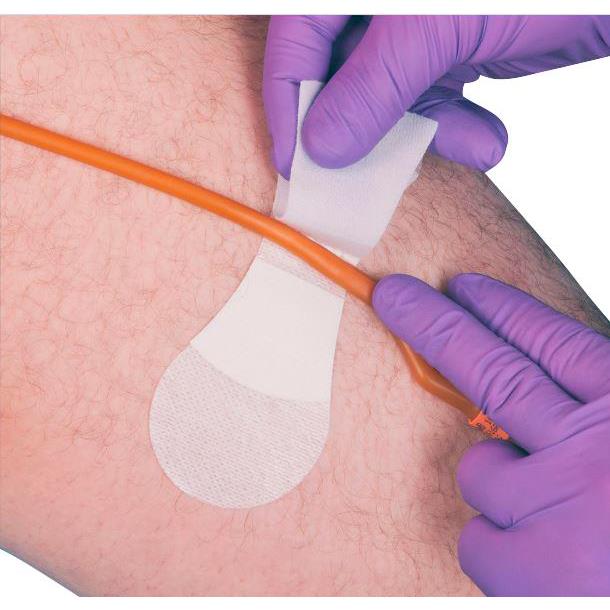 Grip-Lok Securement Devices