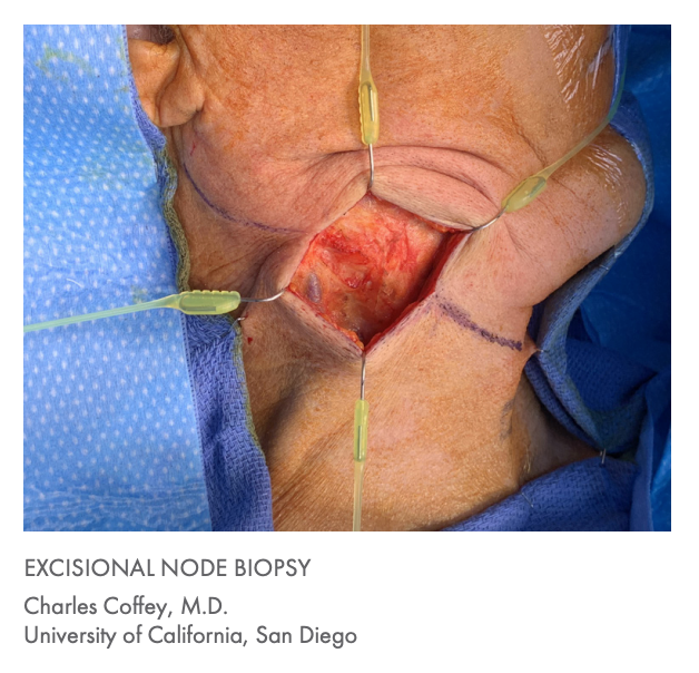 Lone Star Head-Neck Retractor System and Elastic Stays