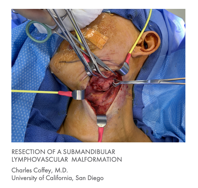 Lone Star Head-Neck Retractor System and Elastic Stays