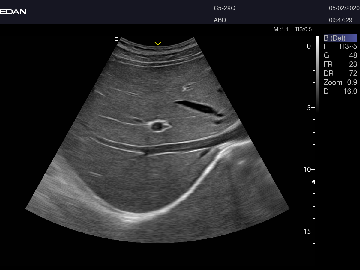 Edan Acclarix AX8 Ultrasound Machine