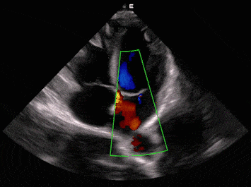LX9 Diagnostic Ultrasound Machine Minerva Health Solutions Inc.