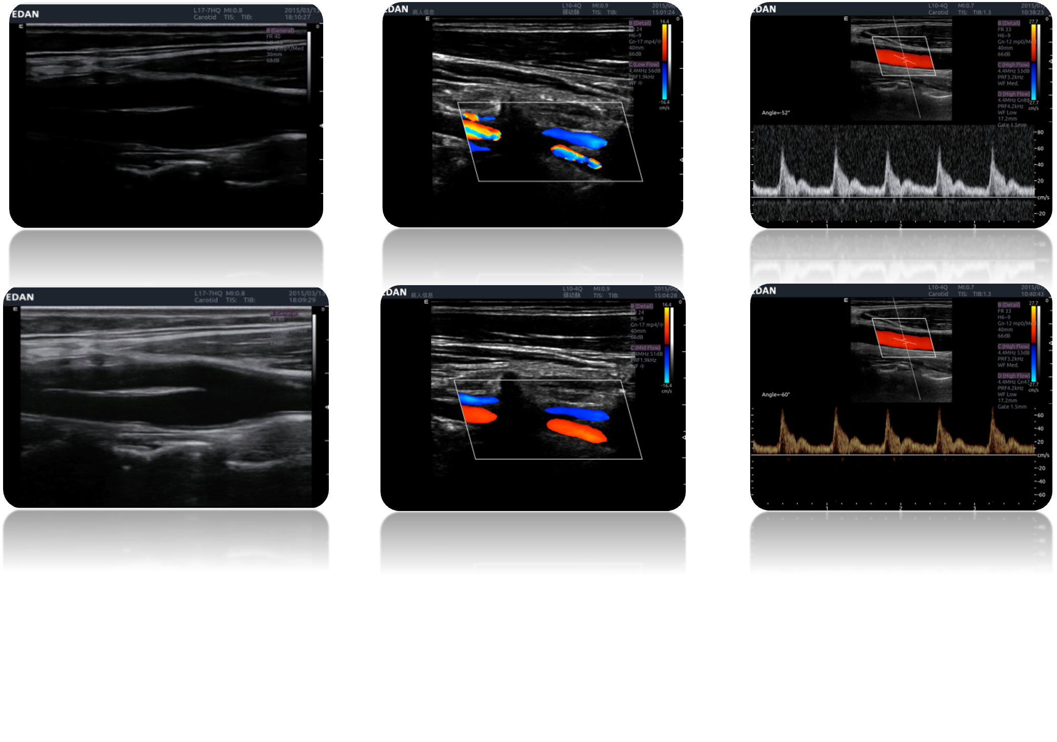 LX9 Diagnostic Ultrasound Machine Minerva Health Solutions Inc.