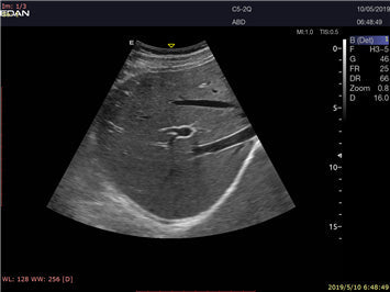 LX9 Diagnostic Ultrasound Machine Minerva Health Solutions Inc.