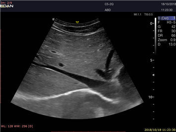 LX9 Diagnostic Ultrasound Machine Minerva Health Solutions Inc.