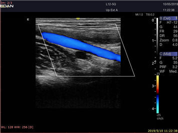 LX9 Diagnostic Ultrasound Machine Minerva Health Solutions Inc.