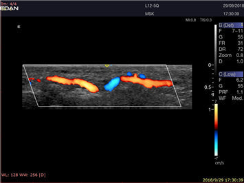 LX9 Diagnostic Ultrasound Machine Minerva Health Solutions Inc.